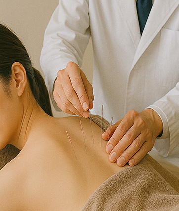 鍼灸施術画像